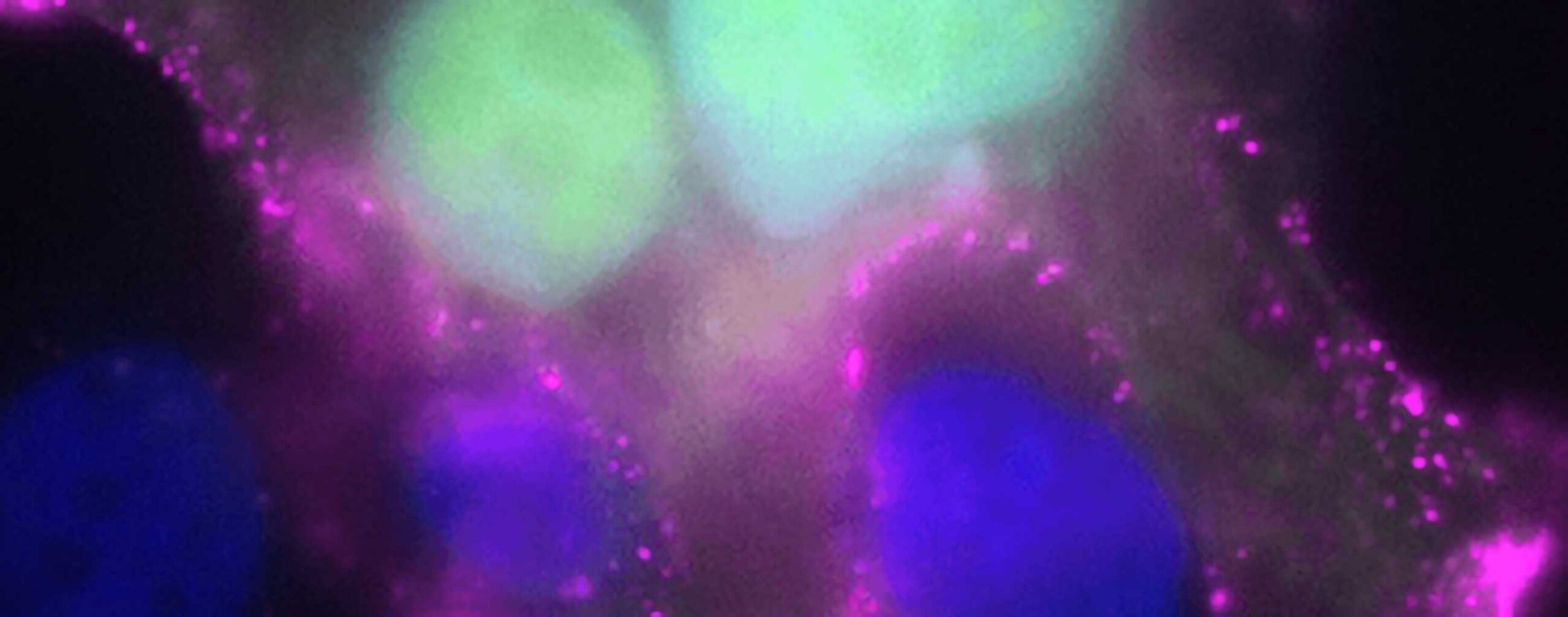 Optimierte Wirkstoffe gegen RSV – Forschungsprojekt „OPERA“ zur Weiterentwicklung antiviraler Wirkstoffe gestartet